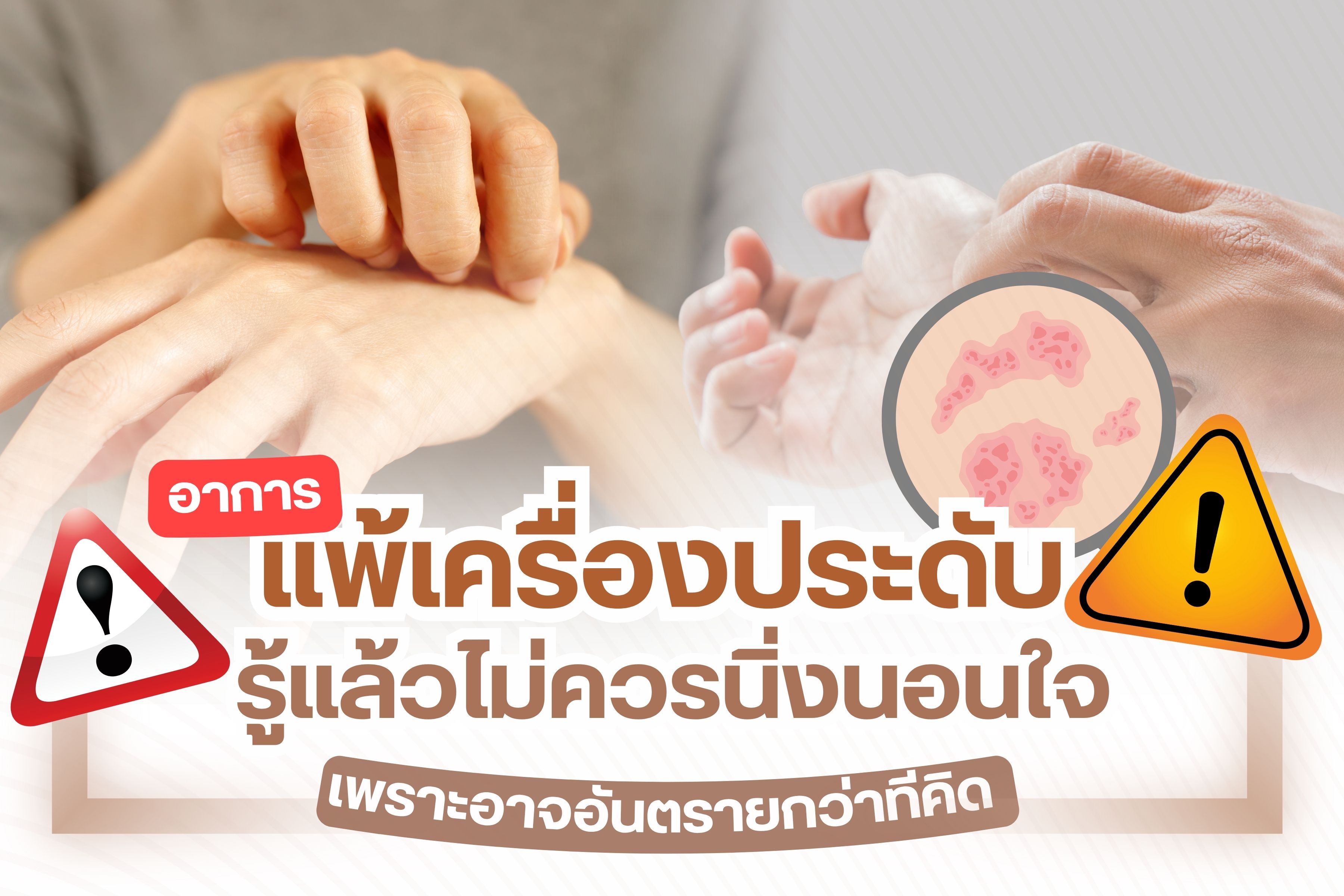 แม้ว่าการสวมใส่เครื่องประดับ จะทำให้เสริมบุคลิกดูเด่นและให้ความสวยงามมากขึ้น แต่กลับมีเรื่องที่ผู้สวมใส่ควรระวังมากที่สุด คือ อาการแพ้ที่อาจพาให้คุณต้องถึงอันตรายแก่ชีวิตได้ ซึ่งอาการแพ้นั้นอาจเกิดขึ้นได้จากการแพ้สารประเภทใดประเภทใดภายในเครื่องประดับ จึงทำให้กลายเป็นอาการคัน ผื่นขึ้น และอาจลุกลามจนผิวหนังเสียหาย ดังนั้นจึงถือว่าเป็นเรื่องที่ไม่ควรนิ่งนอนใจ เพราะถ้าคุณมีอาการแพ้แล้ว ยังคงสวมใส่เครื่องประดับนั้น ๆ อยู่ย่อมก่อให้เกิดอาการที่รุนแรงได้มากขึ้น